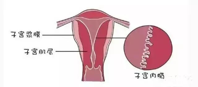 功能性子宫出血