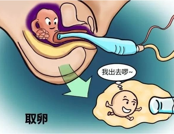 俄罗斯试管婴儿