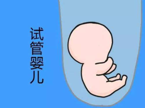 俄罗斯试管婴儿